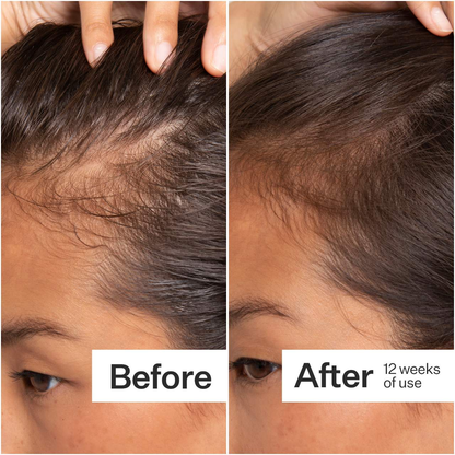 2% Stem Cell H-2 Grow Complex ™ Scalp Serum For Thicker-Looking Hair - 2.2 fl oz